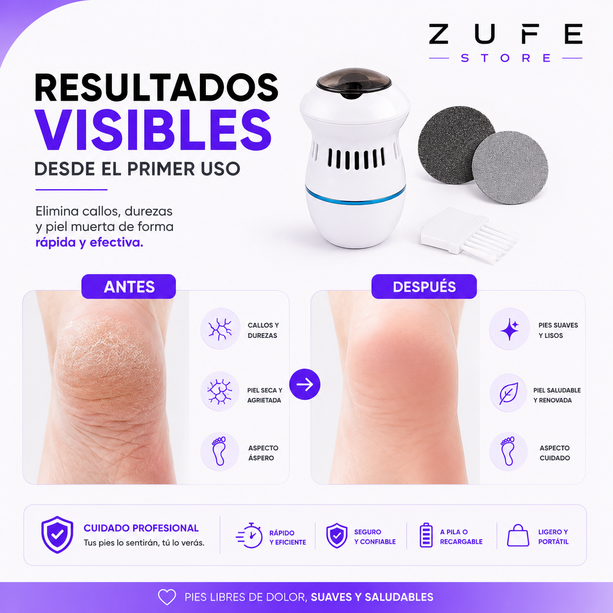 Lima Eléctrica Exfoliante | No más callos e imperfecciones en tus pies